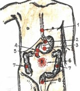 Локализация боли при язве желудка и двенадцатиперстной кишки